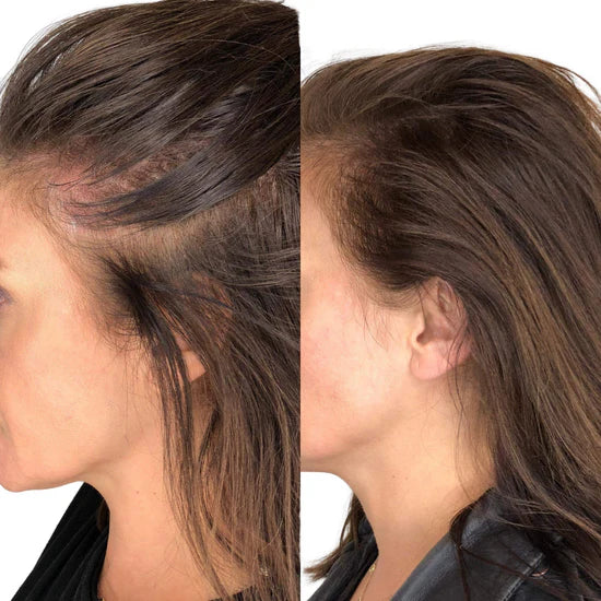 Soléya® - Brosse Stimulante pour le cuir chevelu & la pousse